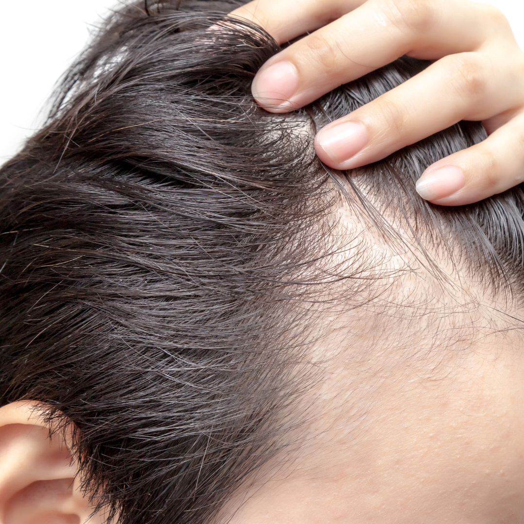 Hair Growth Kit for Men