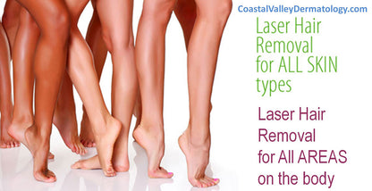 Laser Hair Removal Membership